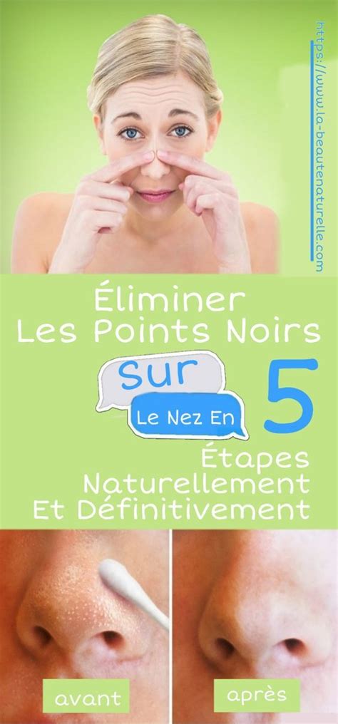 Éliminer les points noirs sur le nez en 5 étapes naturellement et définitivement