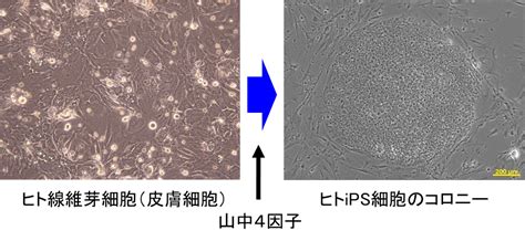 Ips細胞研究｜理研創薬・医療技術基盤プログラム