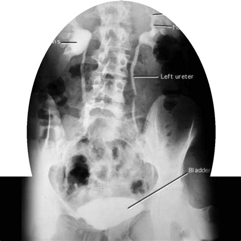 Book Your Ivp Test Intravenous Pyelogram Deep Medical Centre