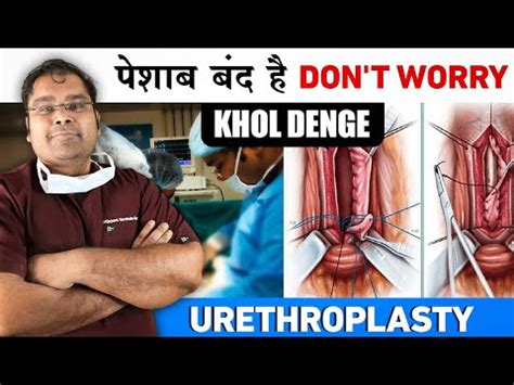 URETHROPLASTY IN INDIA पशब नल क ऑपरशन YouTube