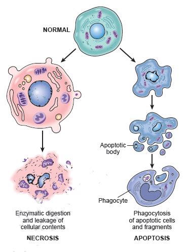 Apoptosis Vs Necrosis Medical Junction