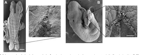 Figure 5 from Neural tube closure: cellular, molecular and ...