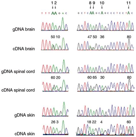 For Each Tissue Both The Gdna And The Corresponding Cdna Are Shown