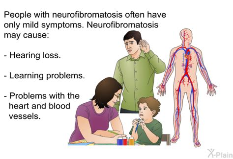 PatEdu.com : Neurofibromatosis