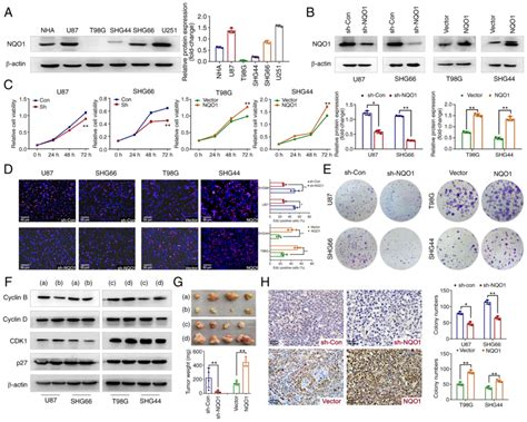 Nqo Drives Glioblastoma Cell Aggressiveness Through Emt Induction Via