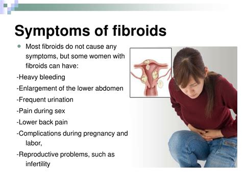 Ppt Uterinefemoral Fibroid Embolization Powerpoint Presentation Free Download Id222744