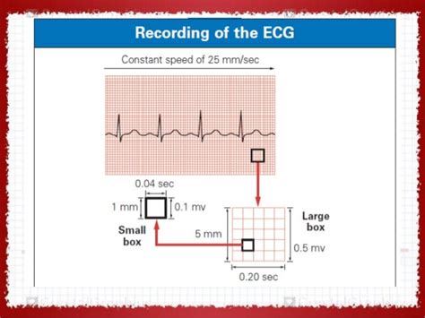 Ecg In Ischemic Heart Disease Dr Vivek Baliga Review