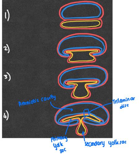 Session 2 And 3 GI Embryology Only Flashcards Quizlet