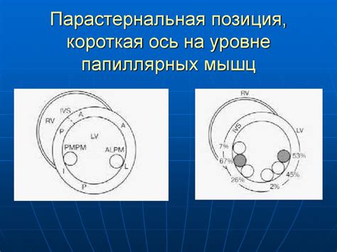 Двумерная эхокардиография - презентация онлайн