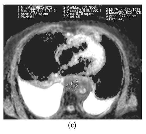 Diagnostics Free Full Text Role Of Diffusion Weighted Magnetic