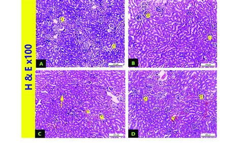 Light Microphotographs Of Sections Form Male Sprague Dawley Rats Renal