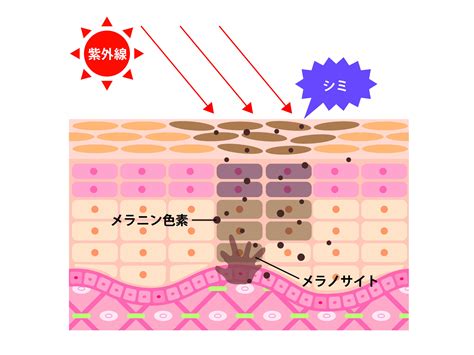 どうしてシミはできるの？シミを防ぐ方法やスキンケアのポイントを紹介│無添加化粧品・健康食品・サプリメント通販のファンケルオンライン