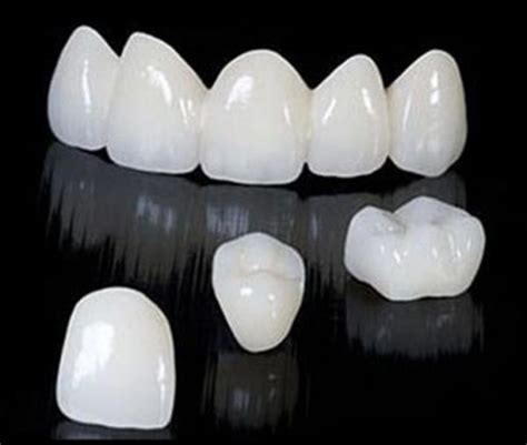 ZIRCONIA CROWNS – DENTAL IMPLANT SPECIALITY CENTRE