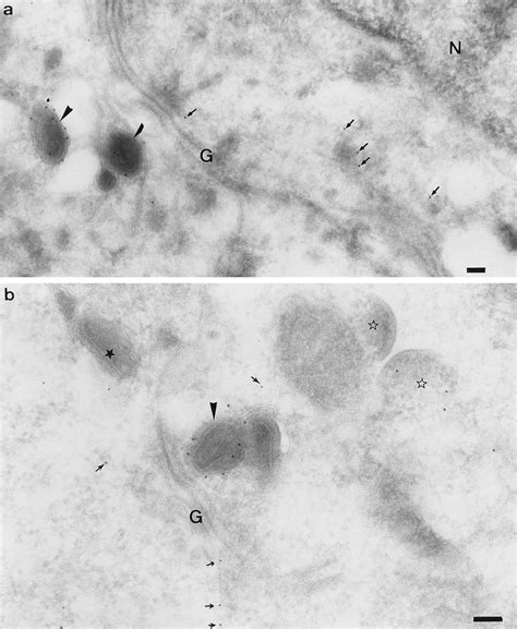 Labelling For P32 In The Perinuclear Region Of HeLa Cells At 8 H