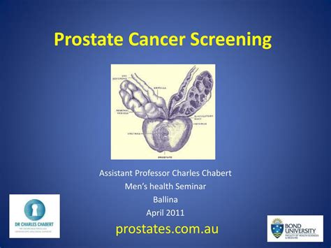 Ppt Prostate Cancer Screening Powerpoint Presentation Free Download Id 1430892