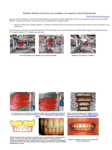 Pdf Enfilado Dentario De Pr Tesis De Completa Con Esquema Oclusal