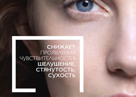Диета при атопическом дерматите [у взрослых и детей] — что можно есть