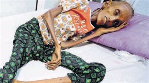 Distressing Images Of Starving Yemen Kids Stun World - LBC