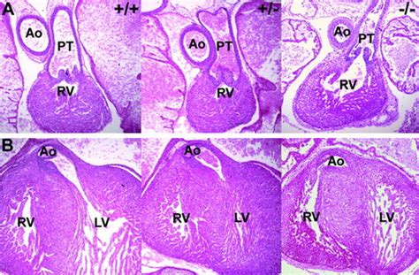 Coronary Vessel Development Is Dependent On The Type Iii Transforming