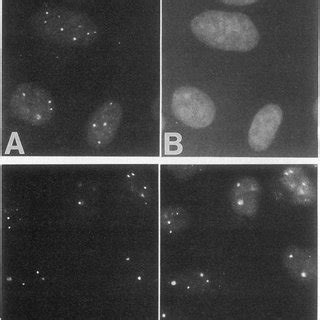 Indirect Immunofluorescence Of HeLa Cells With Anti ND Sera A Human