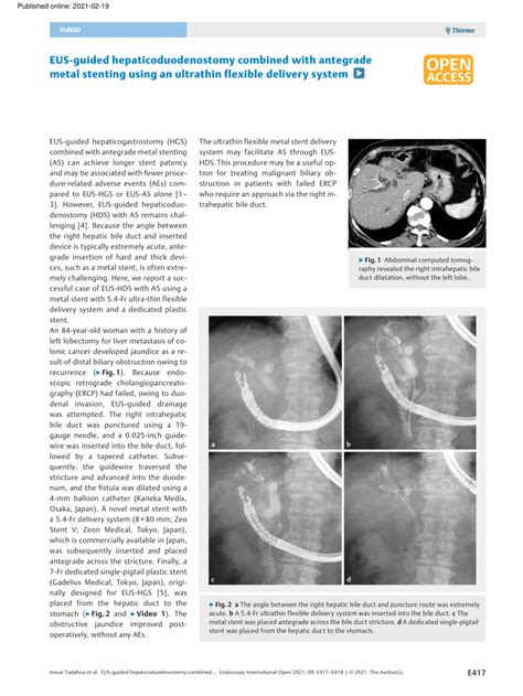 Pdf Eus Guided Hepaticoduodenostomy Combined With Antegrade Metal