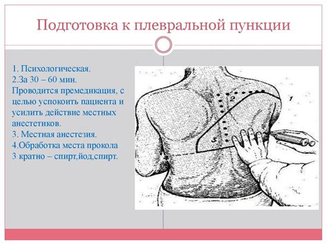 Плевральная пункция - презентация онлайн