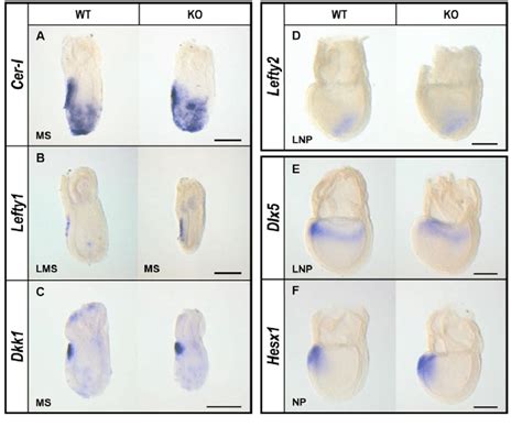 Ave Is Established And Functional And Expression Of Lefty2 In Lpm Is