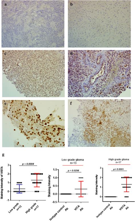 Immunohistochemical Staining Of Vista Revealed Elevated Expression