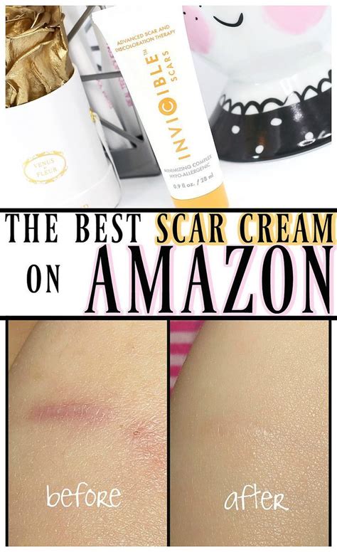 Scar Removal Cream Artofit