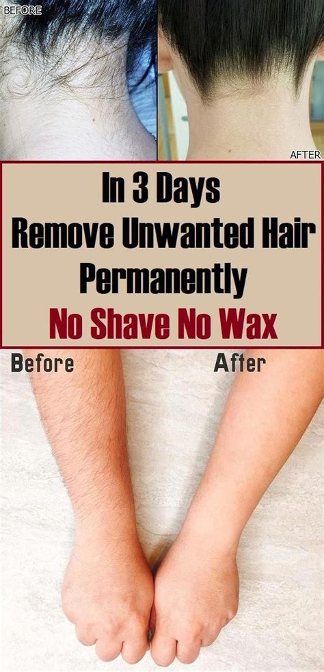 In 3 Days Remove Unwanted Hair Permanently No Shave No Wax In 2022 Unwanted Hair Removal