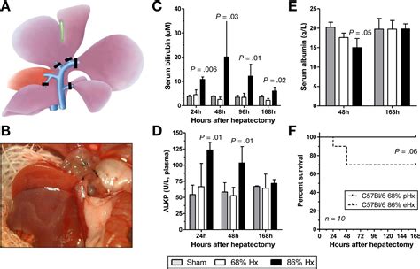 Liver Failure After Extended Hepatectomy In Mice Is Mediated By A P21