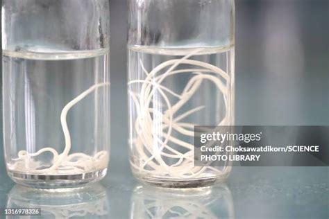 416 Intestinal Worms Stock Photos High Res Pictures And Images