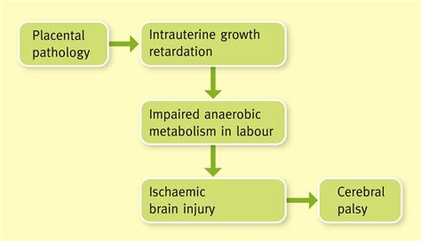 Aetiology And Epidemiology Of Cerebral Palsy Paediatrics And Child Health