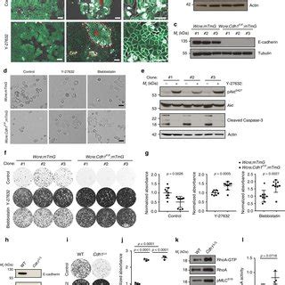 Relaxation Of Actomyosin Contractility Drives ILC Formation A