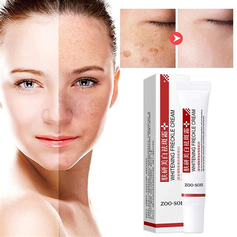 Crema Blanqueadora Para Eliminar El Melasma Manchas Oscuras Melanina