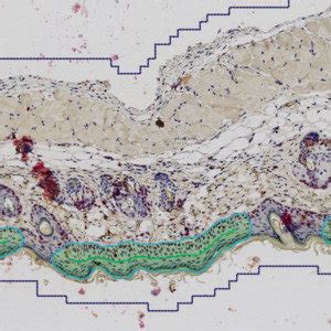 Ki Epidermal Hyperplasia Visiopharm Pathology Image Analysis