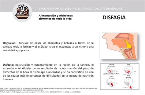 Las Personas Con Alzheimer Y Disfagia Pueden Sufrir Pérdida De Peso Y Desnutrición Líder En