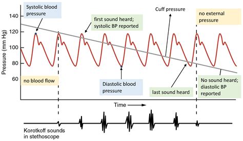 Sensors Free Full Text A Survey On Blood Pressure Measurement