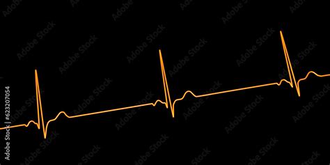 Electrocardiogram Ecg Displaying Sinus Bradycardia D Illustration