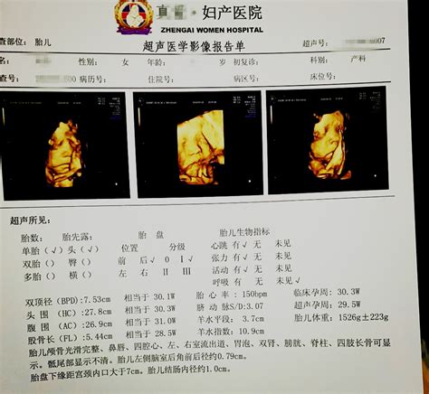 孕期检查 标签 得意生活