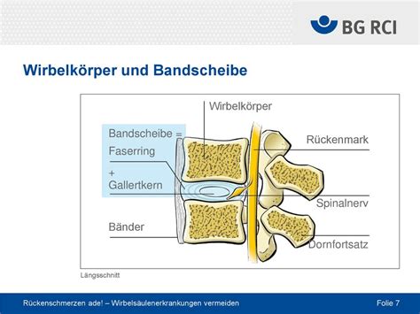 Rückenschmerzen Ade Wirbelsäulenerkrankungen Vermeiden Ppt Herunterladen