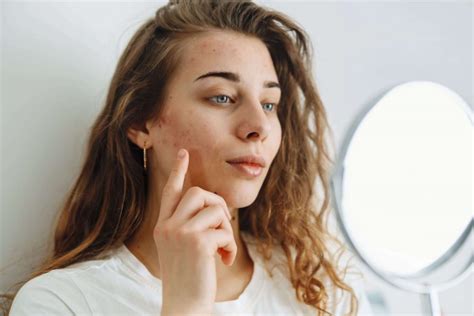 Routines Pour Lutter Contre Les Imperfections Du Visage