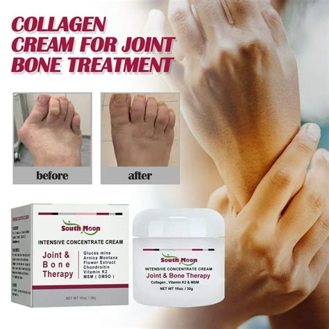 South Moon Joint Collagen Cream Soothes Joint And Bone Pain And Deformity Correction Repair