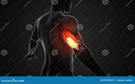 Pain and Injury in the Triceps Muscles Stock Illustration ...