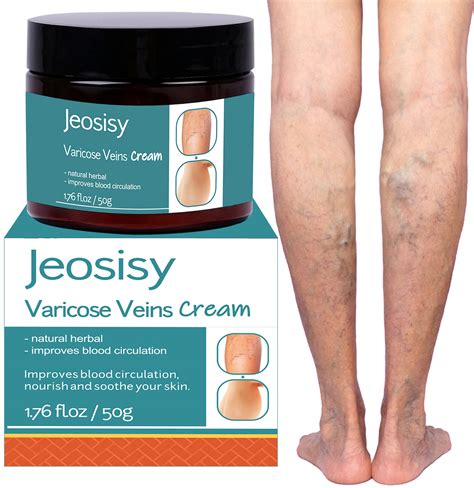 Buy Varicose Vein Cream Varicose Veins Cream For Legs Varicose