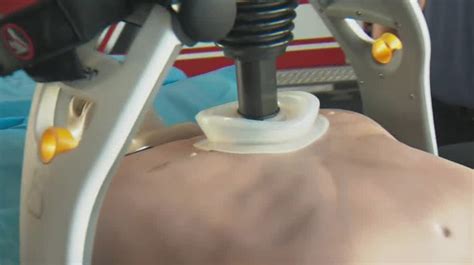 This Auto Chest Compression Device Is Saving Lives In Central Florida