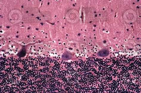 Mammal Cerebellum Sagittal Section 250X Cerebellum Mammals