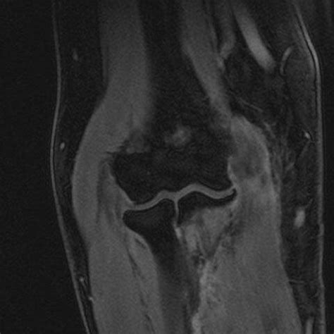 Galerie Radiologischer Leistungen Schauen Sie Sich Unsere