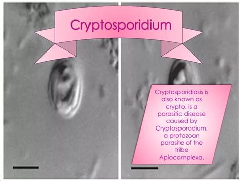 Ppt Cryptosporidium Powerpoint Presentation Free Download Id9600241