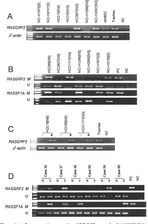 Figure 1 From Aberrant Methylation Of RASGRF 2 And RASSF 1 A In Human